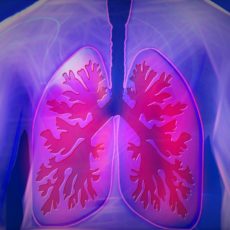 Vitamin D bei COPD Vitamin D bei COPD