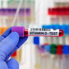 Freies Vitamin D – neue Diagnostik oder überschätzter Laborwert?