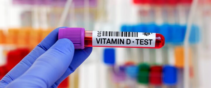 Freies Vitamin D – neue Diagnostik oder überschätzter Laborwert?